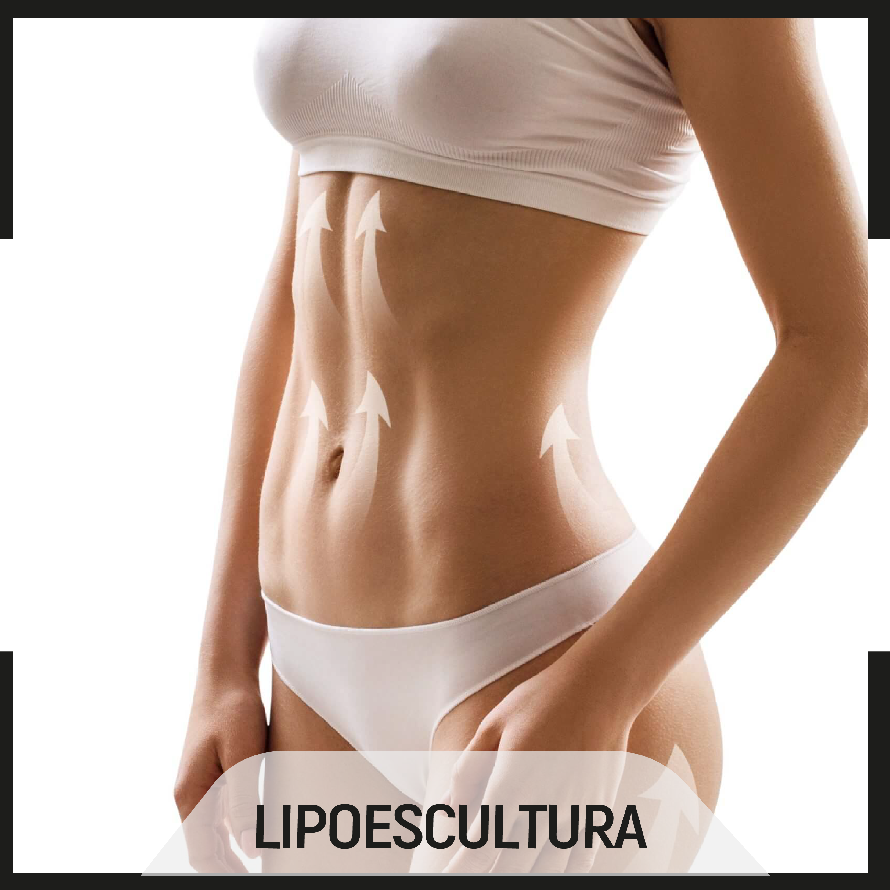 casos sobre lipoescultura