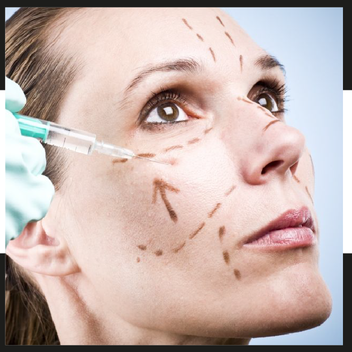 Aplicacíon de grasa